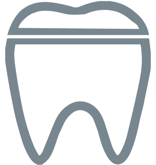 Dental Inlays And Onlays – Hutt Dental Hub