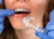 woman-getting-clear-braces-fitted