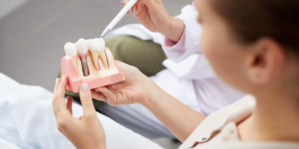 dental-implants-for-missing-teeth-1920×960 (1) dental-implants-for-missing-teeth-1920x960