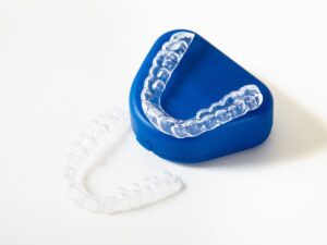 Clear Aligners