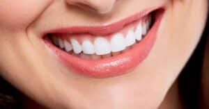 Braces