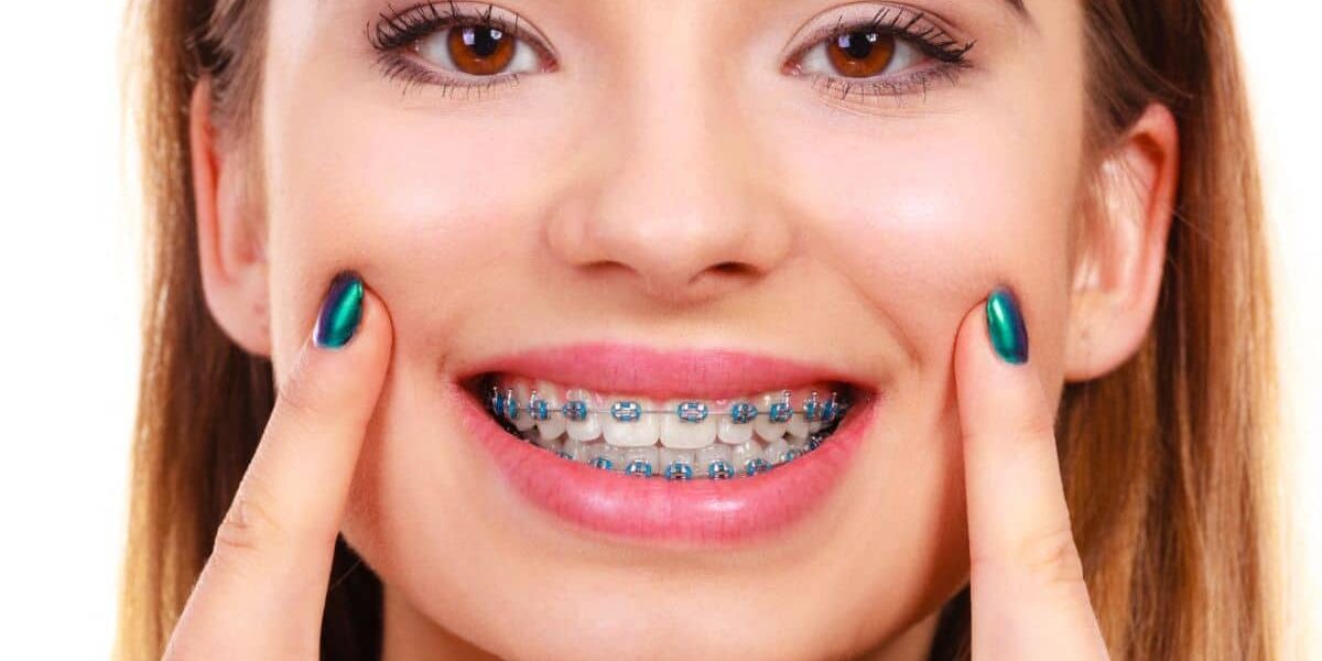 Braces