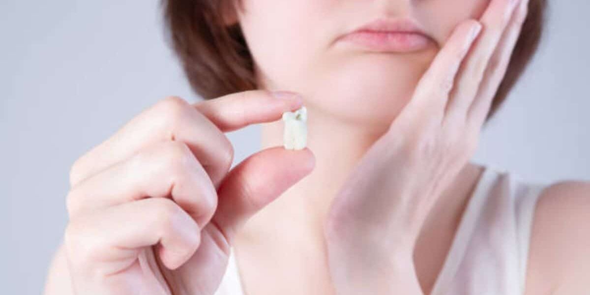 Wisdom Tooth Removal