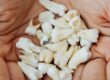 Wisdom Tooth Removal
