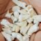 Wisdom Tooth Removal