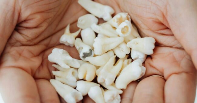Why Does Wisdom Tooth Removal Cause Swelling Wisdom Tooth Removal