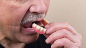 Dentures