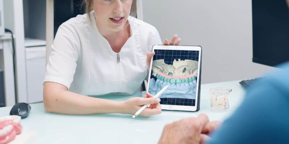Full Mouth Dental Implants