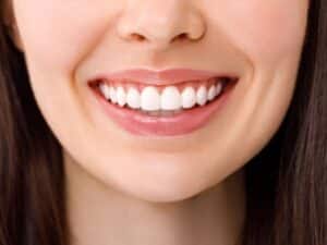 Teeth Whitening